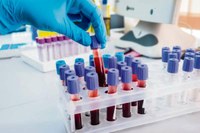 Nova Andradina: Mulheres passarão a ter direito a exame genético para detectar trombofilia