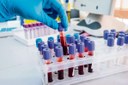 Nova Andradina: Mulheres passarão a ter direito a exame genético para detectar trombofilia