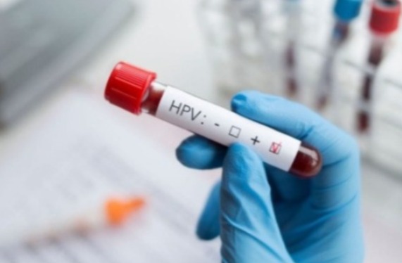 Vereadores indicam adoção de kits de autocoleta para ampliar rastreamento do HPV em Nova Andradina